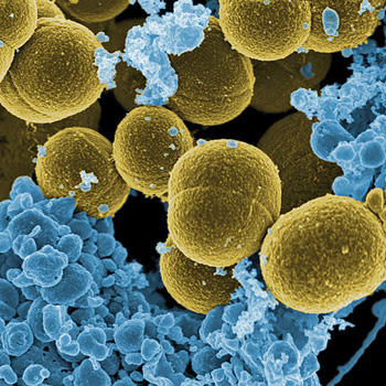 Yellow Bacteria or Wattle? (Image Courtesy of https://www.ucl.ac.uk/